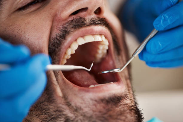 Best Dentist for Tooth Abscess  in Angola, NY